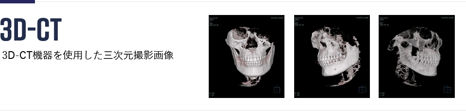 3D-CT機器を使用した、3次元撮影画像