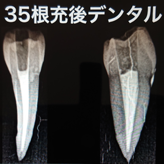 2020年8月1日 RCTコンテストから気付いた事