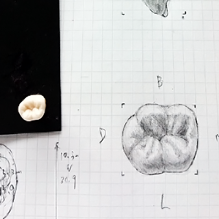2020年8月31日 個々の歯牙のスケッチ終了