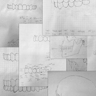 2023年8月27日 歯列とスカルのスケッチ終了