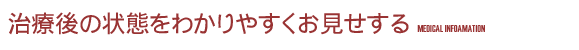 治療後の状態をわかりやすくお見せする