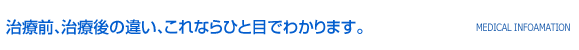 治療前、治療後の違い、これならひと目でわかります。